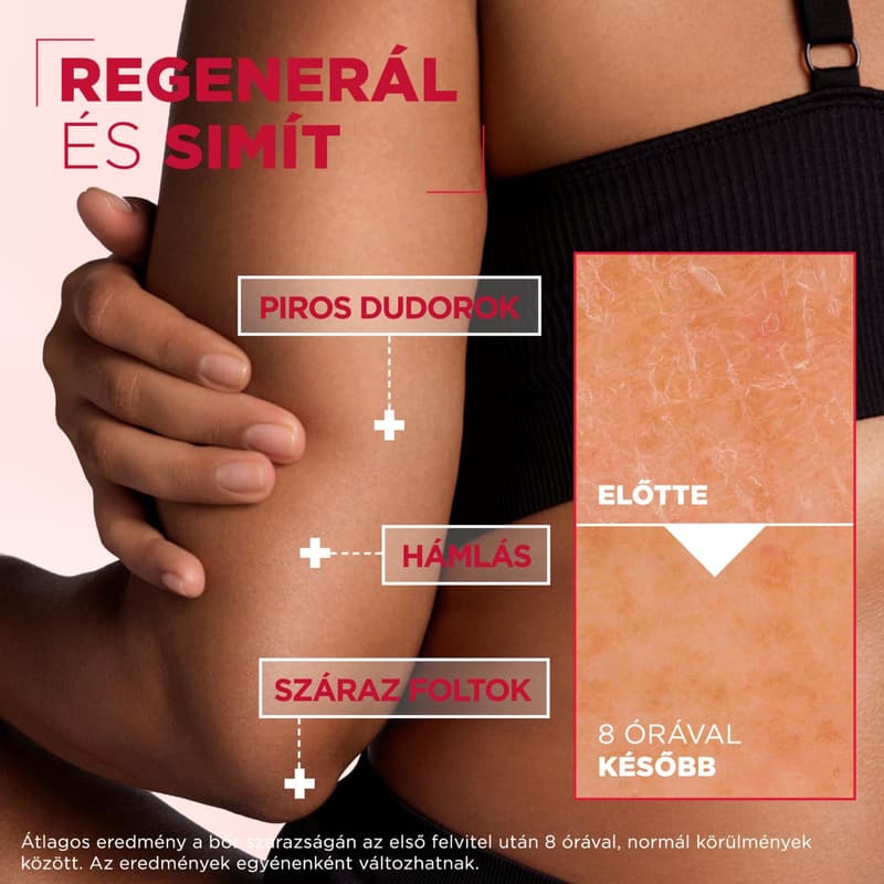 Mixa regeneráló testápoló száraz, durva bőrre