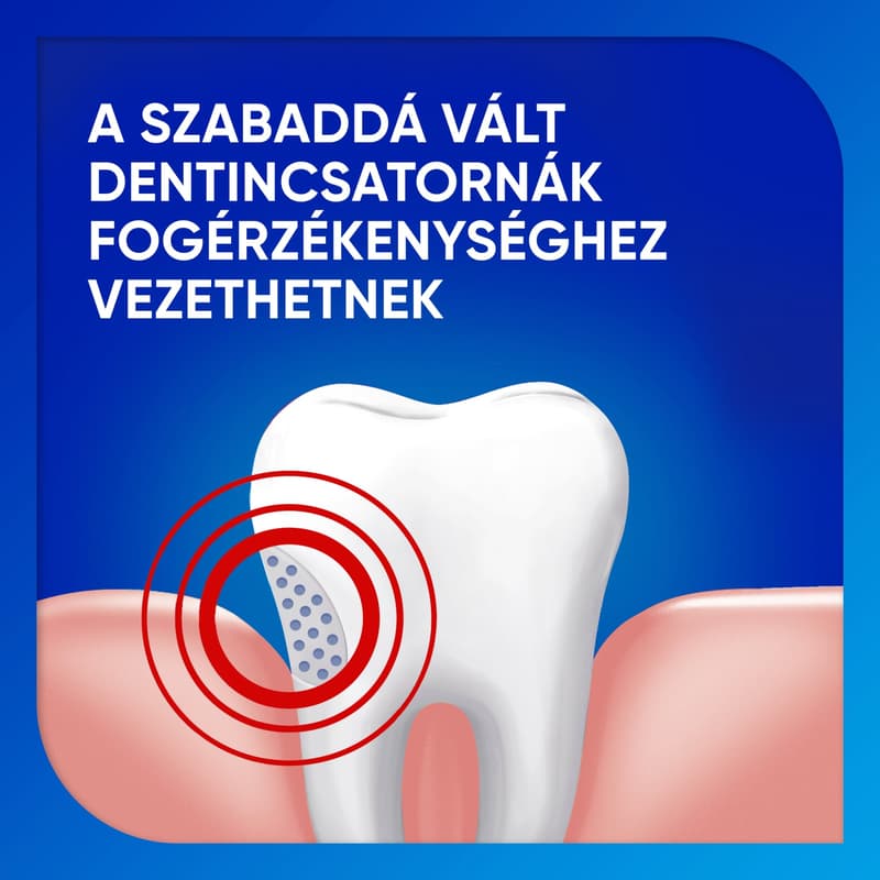 Sensodyne Fluorid fogkrém