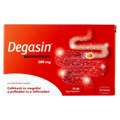 Walmark Degasin simethicone 280 mg soft capsules 32x