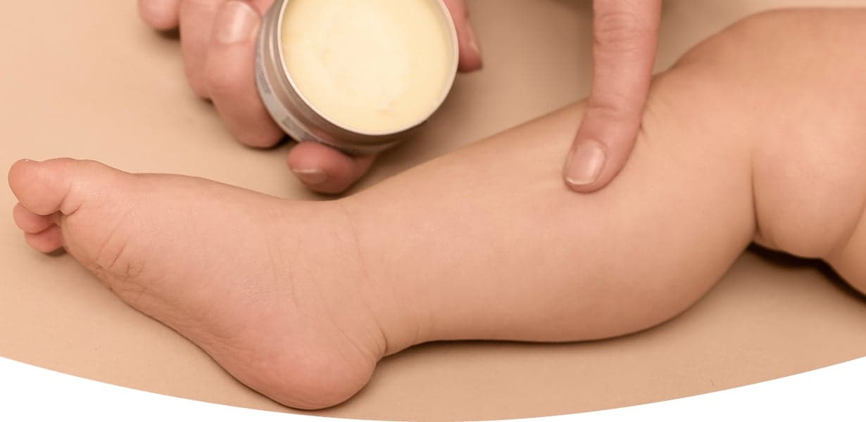 Gyermekkorban előforduló gyakori bőrproblémák (bőrszárazság, kiütések)