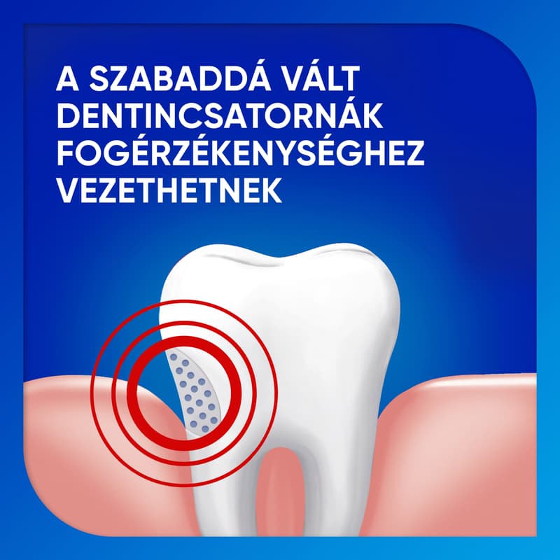 Sensodyne Extra Whitening fogkrém
