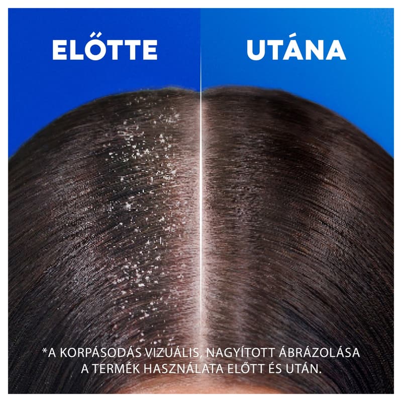 Head & Shoulders Classic Clean Korpásodás Elleni Sampon Az Akár 100%-os Korpamentességért