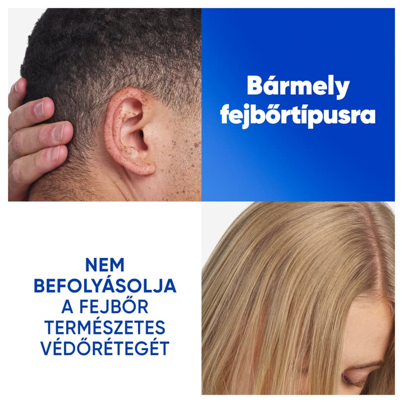 Head & Shoulders Classic Clean Korpásodás Elleni Sampon Az Akár 100%-os Korpamentességért